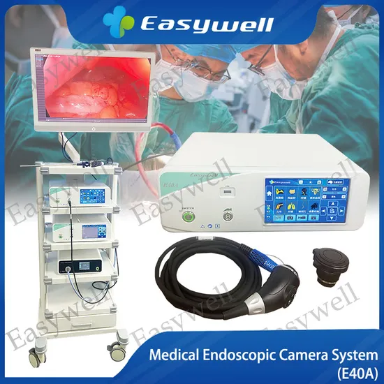 4K Resolution Endoscopy Camera 3840X2160p E40A UHD Imaging System 