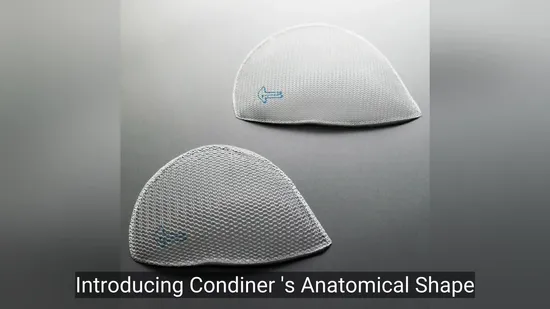 Premium 3D Mesh Material for Inguinal Hernia Repair Solutions 